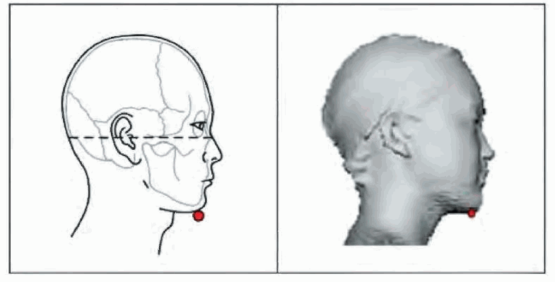 Антропометрический Тип черепа. Развитый подбородочный выступ череп